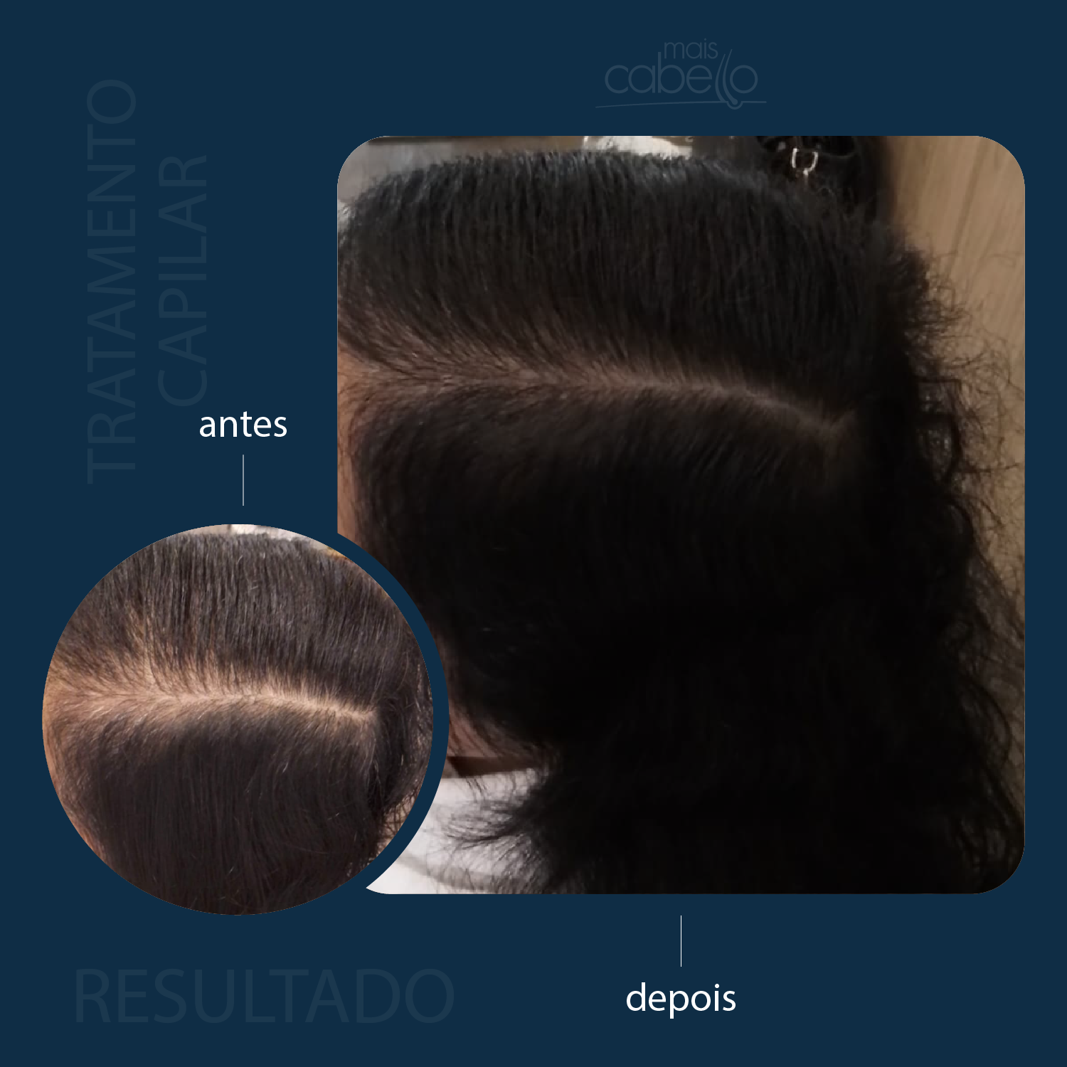 Antes e Depois - Rarefação na Risca